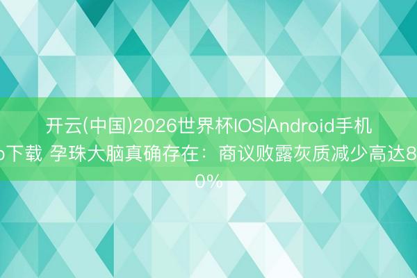 开云(中国)2026世界杯IOS|Android手机app下载 孕珠大脑真确存在:商议败露灰质减少高达80%